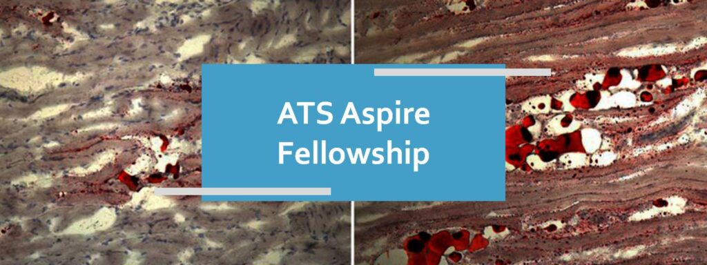 Dr. Annie C. Lajoie (Resident supervisor: Dr. Marta Kaminska) has been awarded the American Thoracic Society's ASPIRE Fellowship for the 2020 cycle
